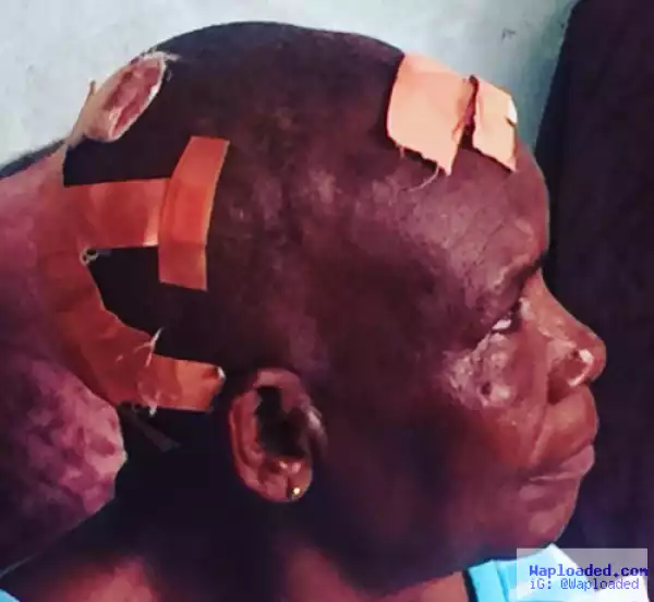 Photos: 68-Year-Old Woman Battered By Her 79-Year-Old Husband In Lagos